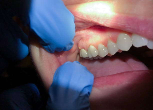 Best Emergency Treatment for Toothache in Ckam Housing, HI