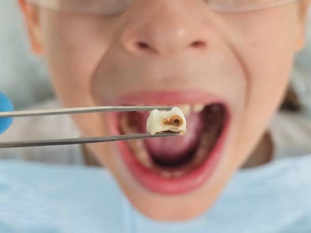 Best Emergency Treatment for Toothache in Ckam Housing, HI